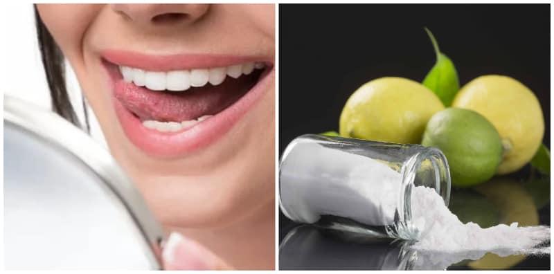 Betul Ke Berkesan Putihkan Gigi Dengan Baking Soda? Ada Rawatan Yang Lebih Selamat!