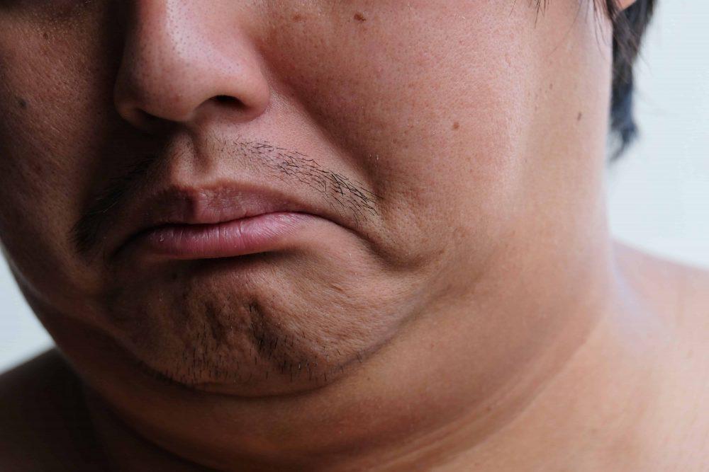 Kenapa Tak Boleh Cakap ‘Gemuk’ Pada Orang Lain?