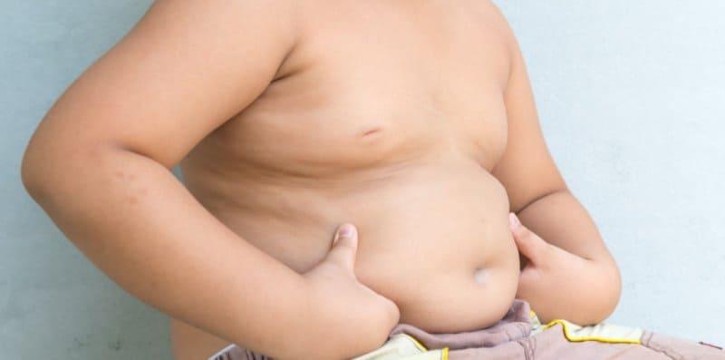 Kanak-Kanak Yang Obesiti Mungkin Kena Buat Rawatan Pintasan Gastrik! Kenapa?
