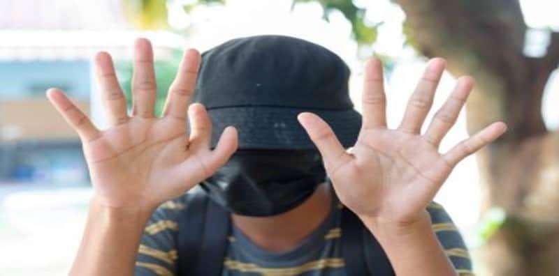 Pelik Tengok Ada Orang Jari Lebih, Kenali Apa itu Polydactyly