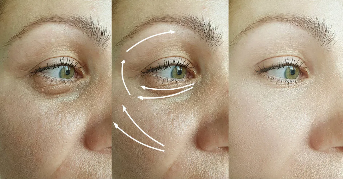 Alamak! Betul Ke Tengok Wayang Salah Satu Punca Muka Berkedut Dan Kusam?