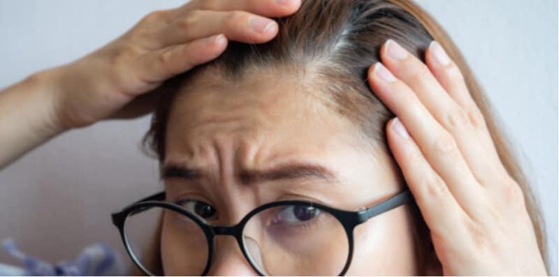 Umur Muda Lagi Tapi Rambut Sudah Mula Nipis, Kena Jaga Kesihatan Mental?