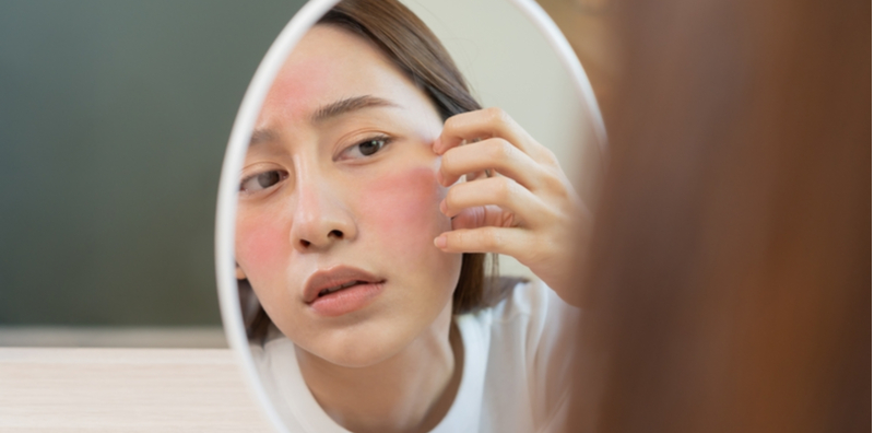 7 Sebab Mengapa Kulit Anda Sering Kering Dan Gatal, Ubah Tabiat Ini Sekarang!