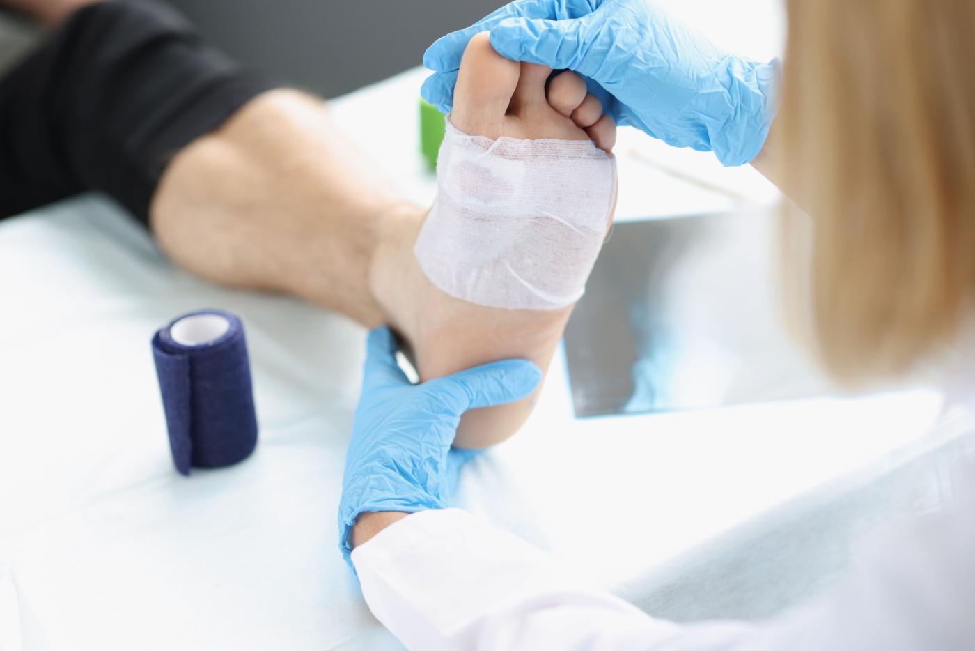 4 Langkah Penting Penjagaan Luka Kencing Manis! Jika Tidak Buat, Lambat Sembuh?