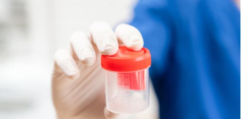 Air Mani Berwarna Merah Ini 7 Puncanya Hello Doktor