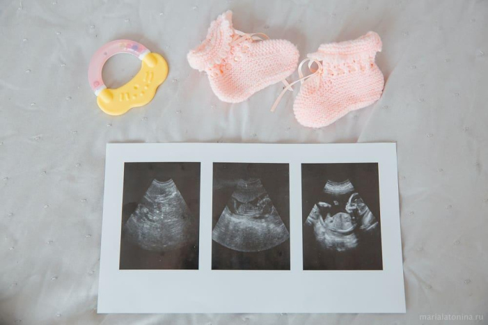 Perkembangan Janin Mengikut Trimester 1 Hingga 3 Hello