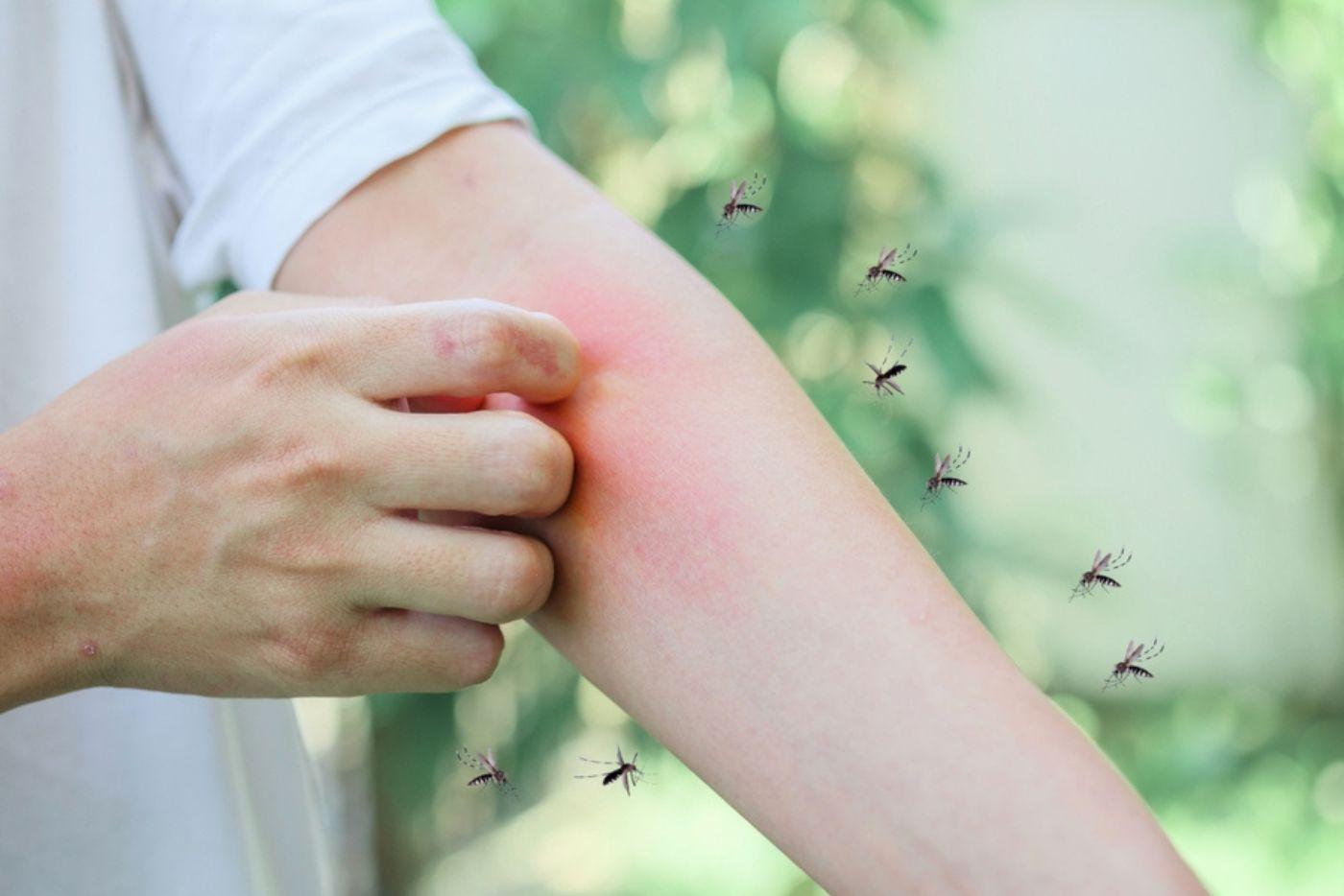 Malaria, Sejenis Penyakit Bahaya Bawaan Nyamuk - Ini 5 Cara Mencegahnya!