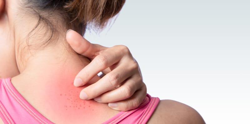 Hairan Kenapa Kulit Seakan Kemerahan Selepas Berjimak? - Ini Punca Sebenarnya!