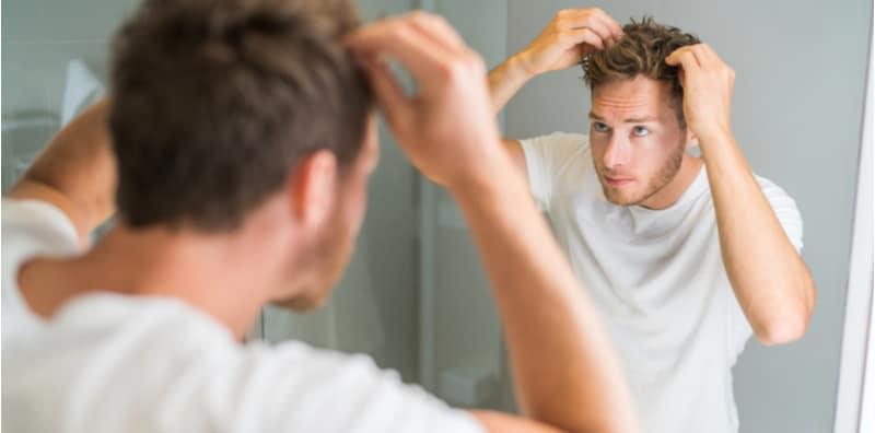 Orang Lelaki, Sebelum Kepala Hampir Botak, Buat Dan Elak 10 Benda Ini Dulu!