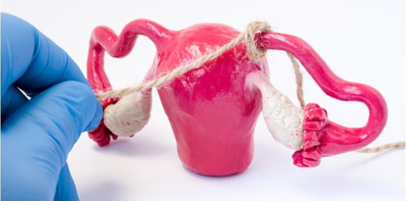 9 Kaedah Semulajadi Untuk Merawat Tiub Fallopio Tersumbat, Ubah Gaya Hidup Anda Sekarang!