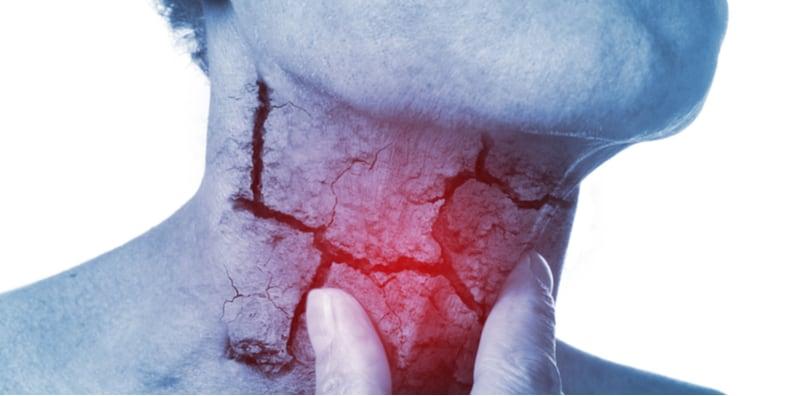 AWAS, Jangan Buat Main Jika Suara Serak. Ia Mungkin Boleh Jadi Punca Bisu!