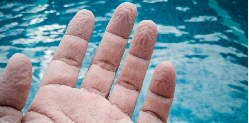 Kulit Berkedut Pada Jari Tangan Dan Kaki Fahami Punca Puncanya