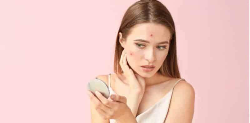 Kerap Melancap Boleh Jadi Punca Banyak Jerawat Di Muka, Betul Ke?
