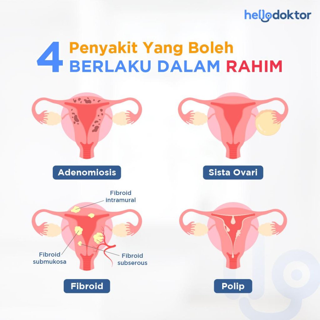 penyakit endometriosis keturunan