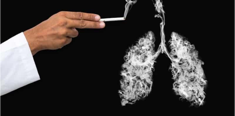 Diagnosis Kanser Paru-Paru, Individu Berisiko WAJIB Buat Pemeriksaan Kesihatan Setahun Sekali