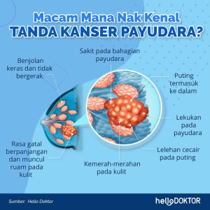 Tanda Kanser Payudara: Simptom Lazim Dan Tidak Lazim