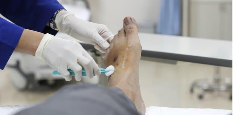 Luka Lambat Sembuh? Awas, Ia Mungkin Tanda Anda Menghidap Kencing Manis!