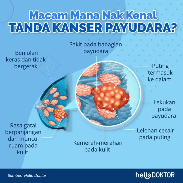 Tanda Kanser Payudara: Simptom Lazim Dan Jarang Berlaku, Kena 'Alert'!