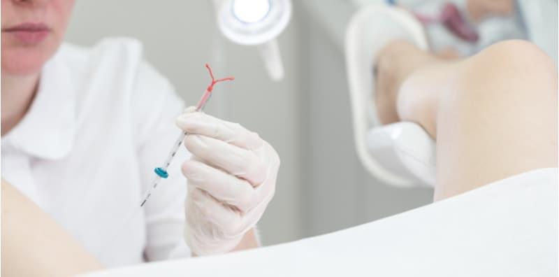 Sudah Pakai IUD Gerenti Tak Hamil? IUD Bukan Alat Pencegah Kehamilan 100% Selamat!