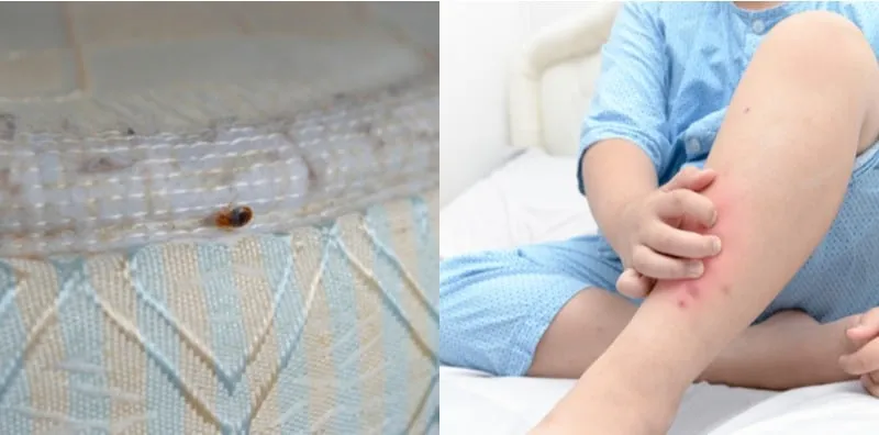 Badan Gatal-gatal Kena Gigit Pepijat? Ini Cara Atasinya