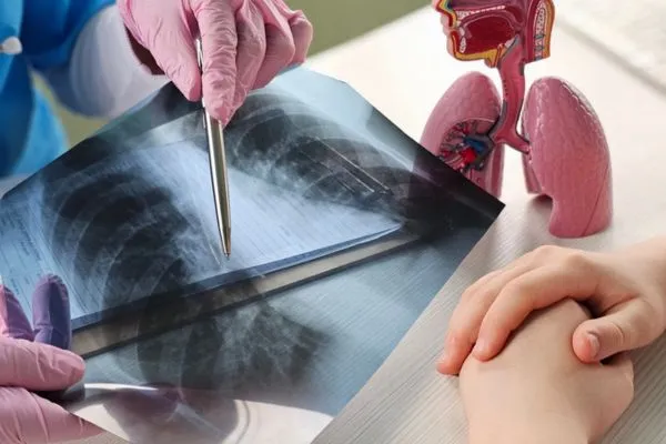 jenis penyakit paru paru 