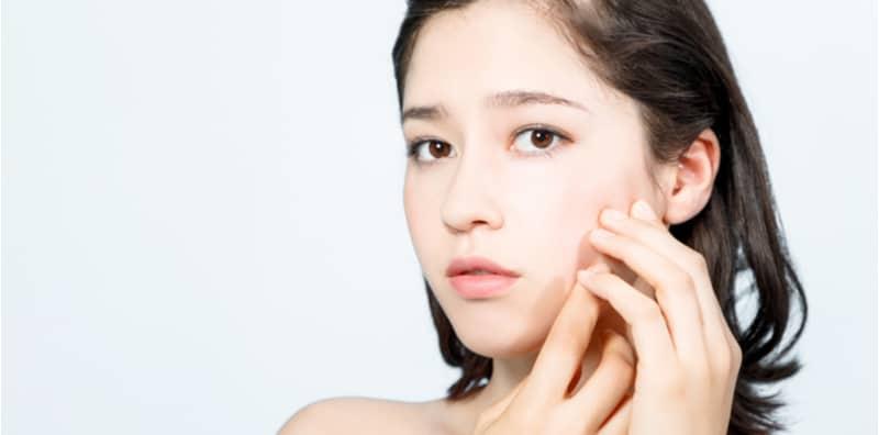 Kulit Naik Jerawat Apabila Bertukar Produk? Sabar! Kenal Pasti Puncanya Dahulu