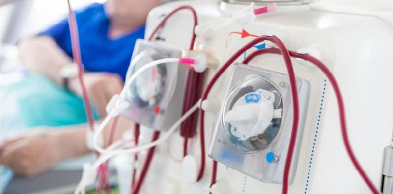 Dialisis, Rawatan Untuk Pesakit Buah Pinggang Yang Berkos Tinggi, Ada Alternatif Lain Ke?