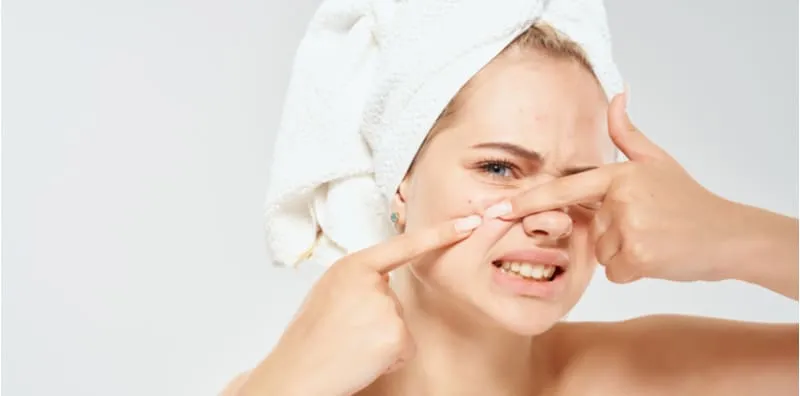 Jangan Pandai-pandai Rawat Jerawat Dengan BAKING SODA! Buruk Kesannya Nanti