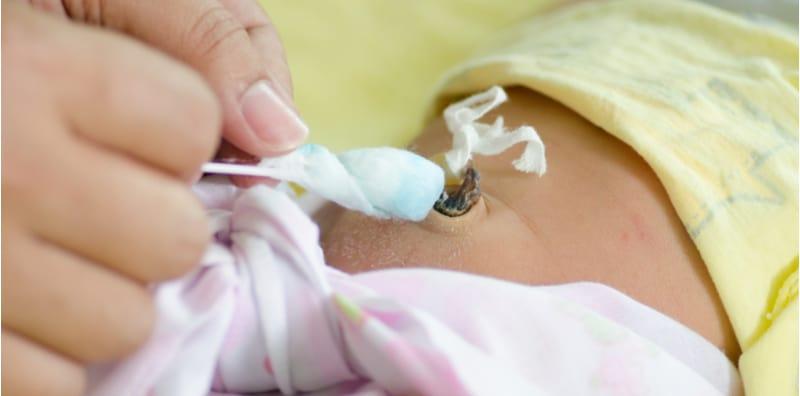 Ibu Baru Bersalin, Awasi 5 Tanda Tali Pusat Anak Terkena Jangkitan, Bahaya Jika Lambat Jumpa Doktor