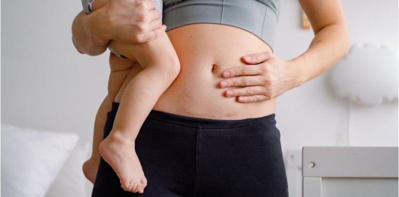 PENTING! Ibu Baru Bersalin Kena Pilih Seluar Dalam Yang Betul, Kalau Tak Nanti Luka Lambat Baik