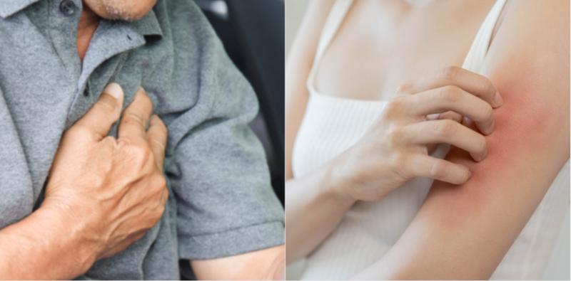 Bahaya! 6 Keadaan Kulit Ini Mungkin Petunjuk Anda Menghidap Penyakit Jantung