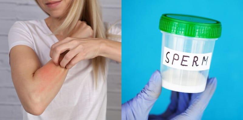 Wanita Alergik Sperma Lelaki, Boleh Hamil? Ia Bergantung Kepada Aspek Ini...