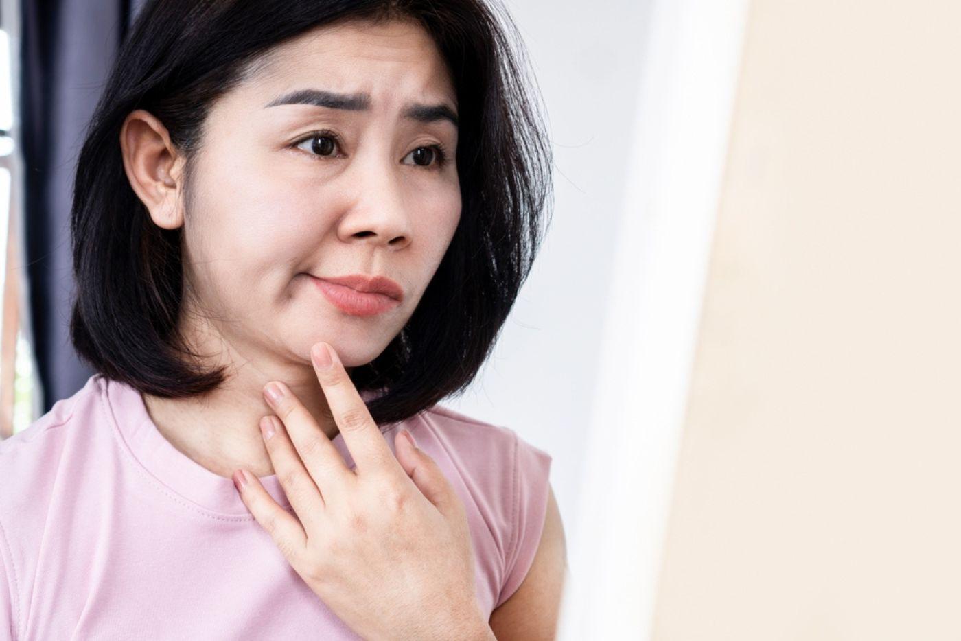 Lumpuh Sebelah Muka? Ini Senaman Yang Paling Sesuai Untuk Pesakit Bell's Palsy