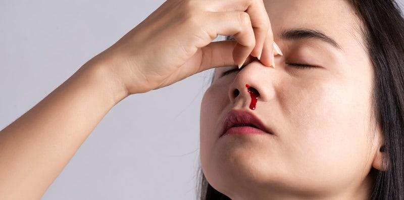 Hidung Selalu Berdarah Dan Tak Henti Mengalir? Ini Petanda Sakit Yang Boleh Ancam Nyawa!
