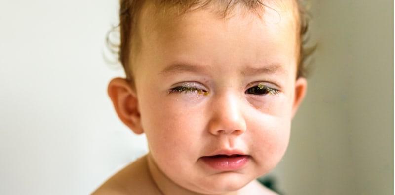 Bayi Baru Lahir Sakit Mata? Ini Mungkin Petanda Dijangkiti Bakteria Sakit Kelamin!