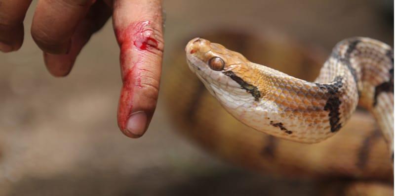 Jangan Tiru Adegan Dalam TV Jika Dipatuk Ular Berbisa! Tenang Dan Ikuti 5 Cara Ini Ya?