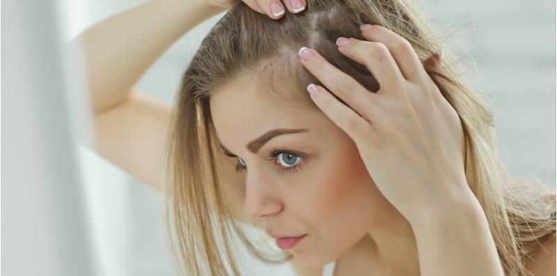 Rimas Dengan Jerawat Di Kepala? Nak Sikat Rambut Pun Pedih? Ini Cara Atasinya