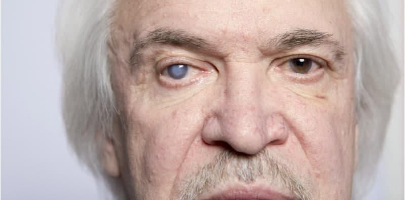 Penghidap Glaukoma, Kenal Pasti 9 Makanan Ini Atau Mata Jadi Lebih Teruk!