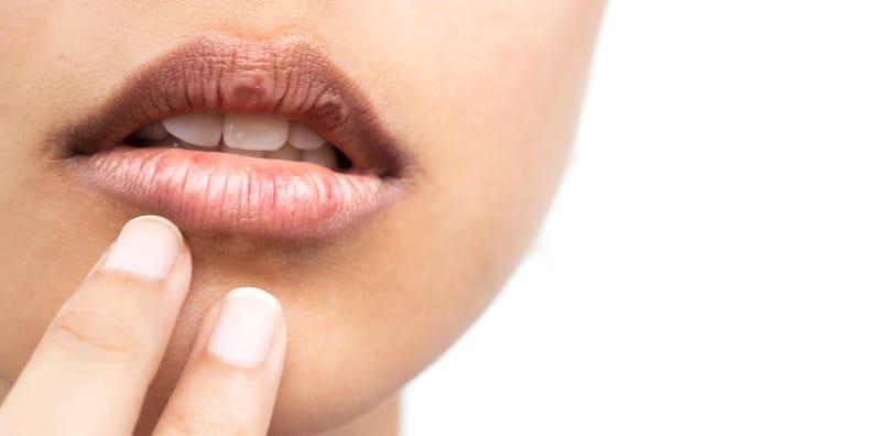 Salah Satu Petanda Hidap Diabetes Adalah Mulut Kering! Jaga-jaga Jika Anda Alaminya