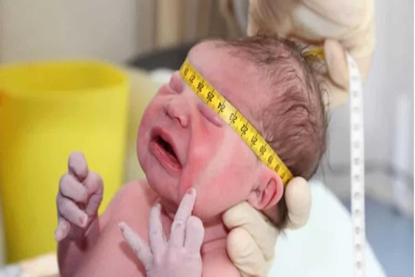 Kelahiran Secara Vakum Buat Kepala Bayi Lonjong? Jom Cuba Tip Ini Untuk Kurangkannya