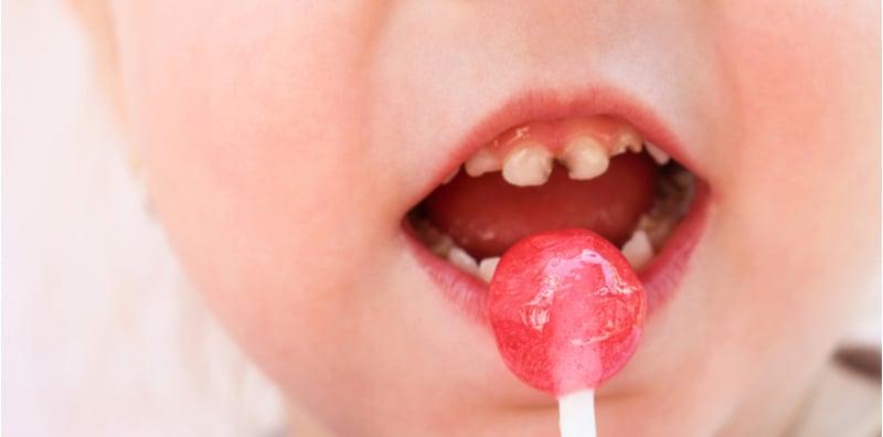 Ibu Ayah, Buat 11 Perkara Penting Ini Untuk Elak Gigi Si Manja Cepat Rosak & Berlubang!