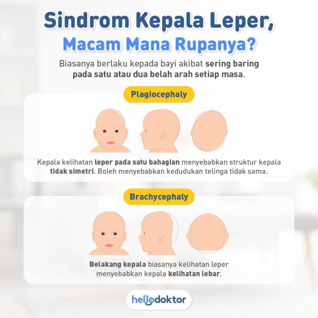 kepala bayi lonjong