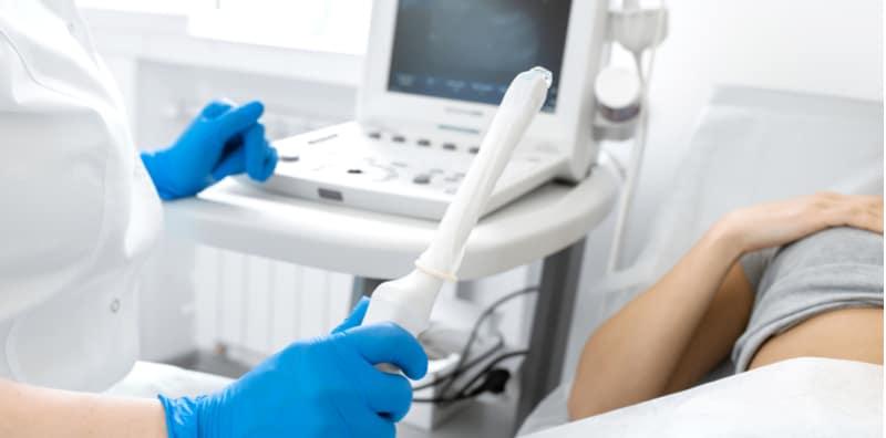 Periksa Rahim Melalui Faraj, Ini Cara Doktor Lakukan Scan TVS Ultrasound Transvaginal