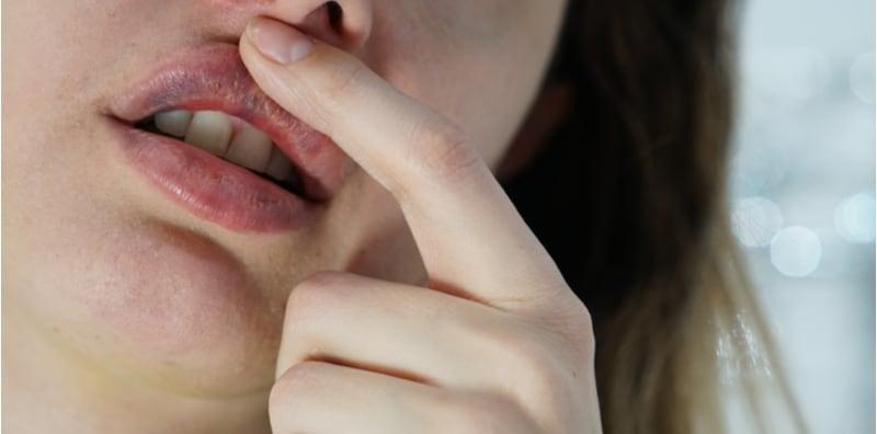 Tak Merokok Tapi Mengapa Bibir Gelap? Ini Punca Bibir Jadi Hitam