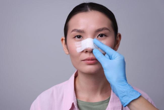 Hidung Berubah Lebam & Keluar Darah, Hati-Hati Anda Mungkin Alami Tulang Hidung Patah!
