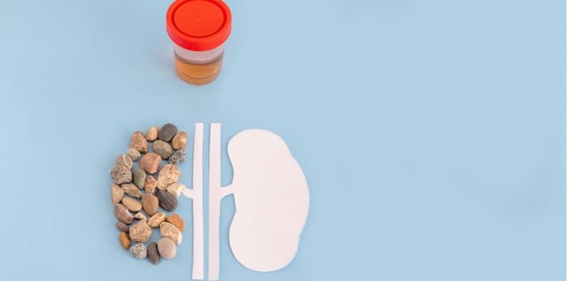 Ada Banyak Simptom Batu Karang, Kenali Jenis-Jenisnya & Rawatan Yang Bersesuaian