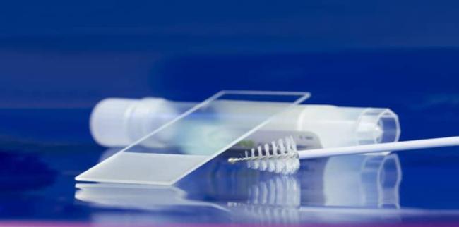 Kini Sudah Ada Ujian HPV Untuk Saringan Kanser Serviks Selain Pap Smear!