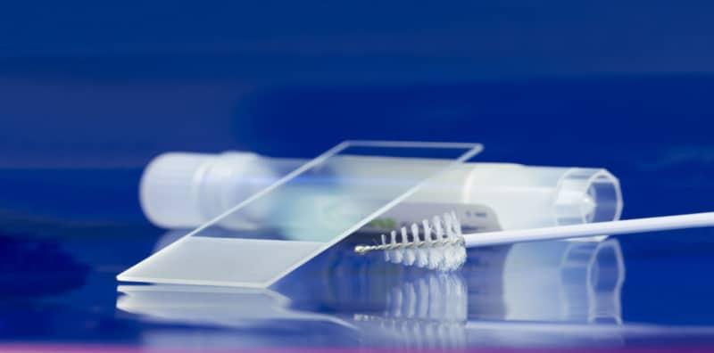 Kini Sudah Ada Ujian HPV Untuk Saringan Kanser Serviks Selain Pap Smear!