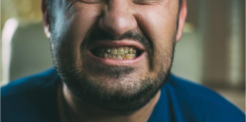 Bagaimana Penjagaan Mulut Yang Buruk Boleh Mempengaruhi Kesihatan Anda?