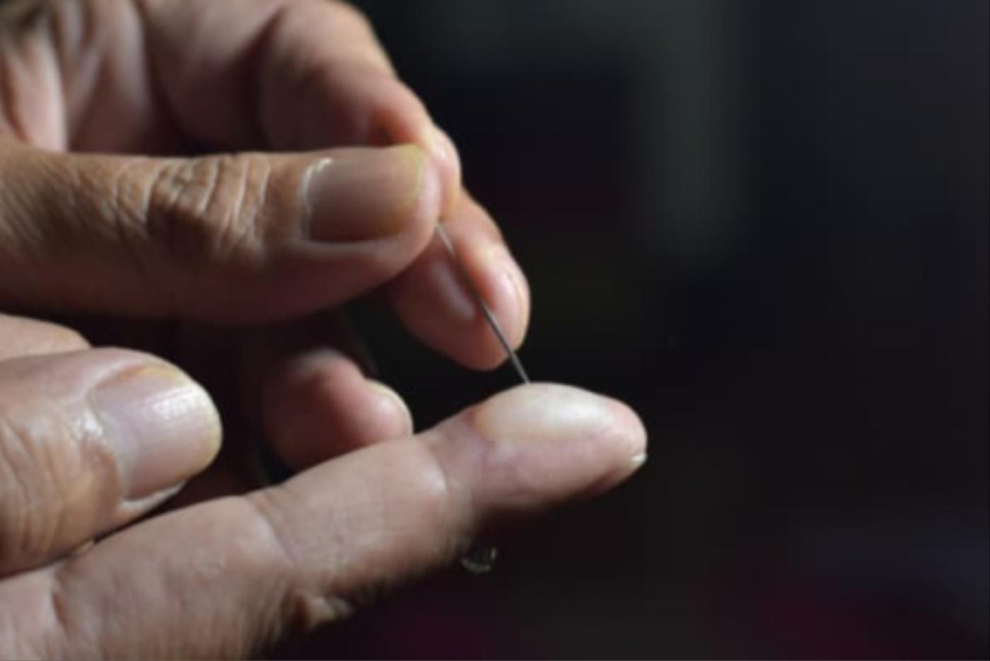 Sebelum Pecahkah Kulit Melepuh, Kenal Pasti Jenisnya Dulu- Silap Gaya Boleh Terkena Jangkitan!